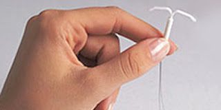 El DIU no es abortivo