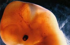 el embrion no es persona